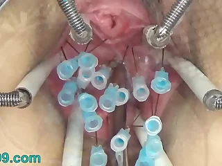 Extreme German BDSM inner Pussy Cervix and Tits